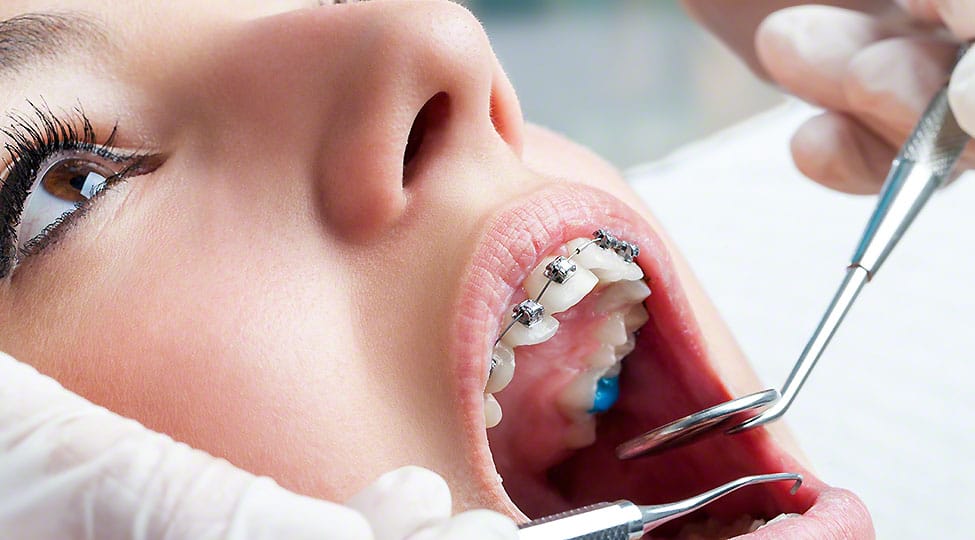 All you want to know about implants for teeth All you want to know about implants for teeth